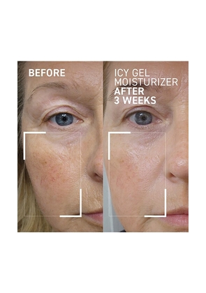 dr. brandt skincare Id-stress Icy Gel Moisturizer in Beauty: NA.
