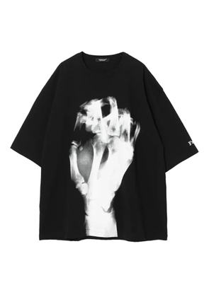 Undercover x-ray print cotton T-shirt - Black
