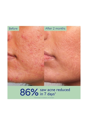 CAUDALIE Vinopure Acne Prone Skin Essentials in Beauty: NA.
