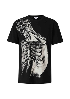 Alexander McQueen anatomy-print T-shirt - Black